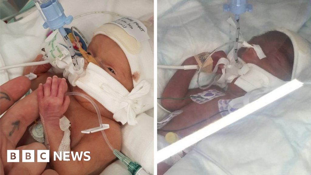 Babies died after London hospital's neglect