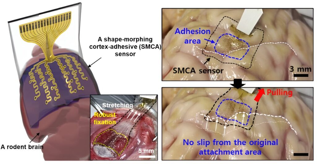 Shape-morphing brain sensor adheres to curved surfaces for ultrasound neurostimulation