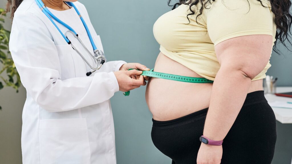 Overall obesity rates in US down while severe obesity continues to rise: CDC